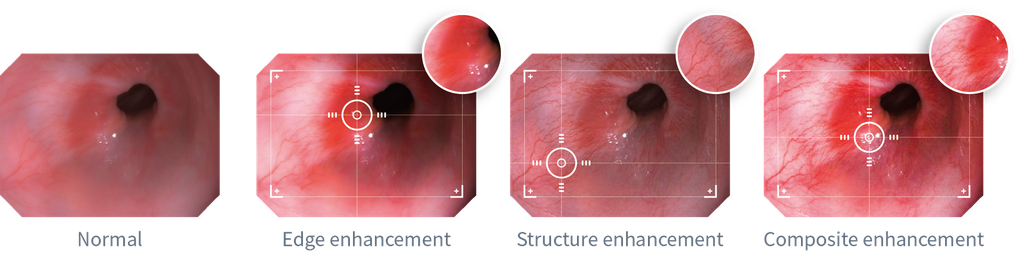 Aohua Vet OR-160 All-in-one Endoskopiesystem